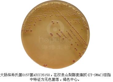 改良山梨醇麥康凱(CT-SMAC)瓊脂
